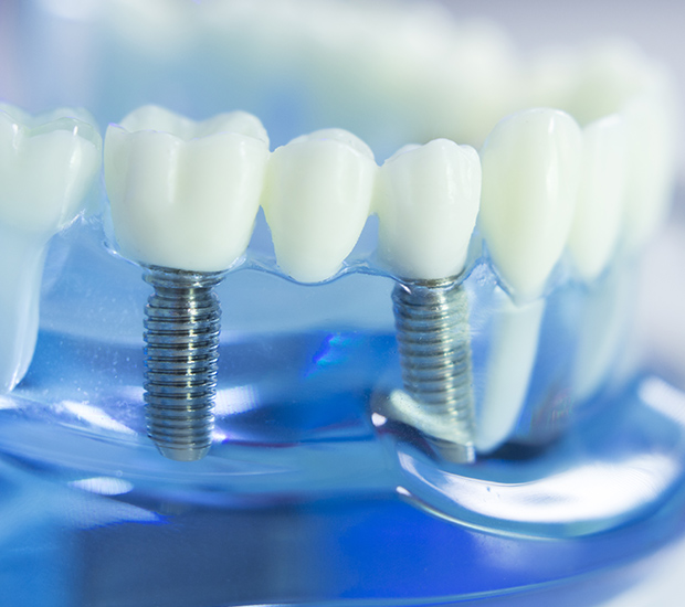 Grand Junction Dental Implants