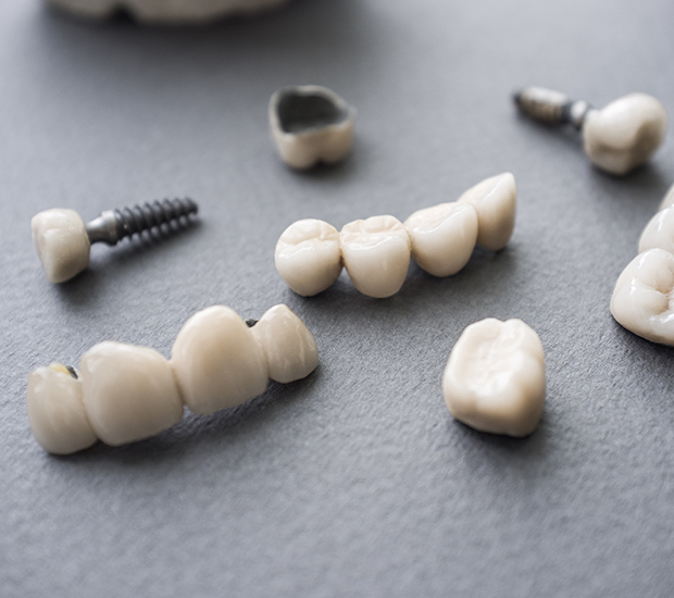 Grand Junction The Difference Between Dental Implants and Mini Dental Implants