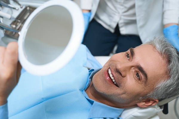 FAQs About Dental Veneers
