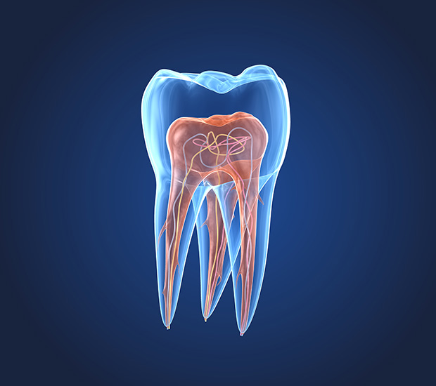 Grand Junction What is an Endodontist